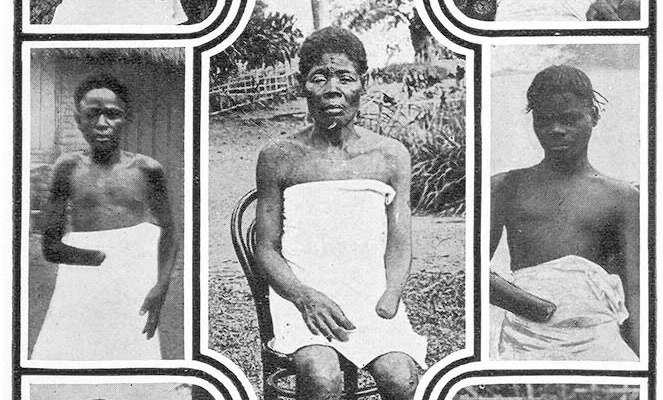 Leopold's policy resulted in a trade of hands